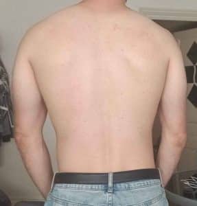 photo de mon dos sans contracter les omoplates