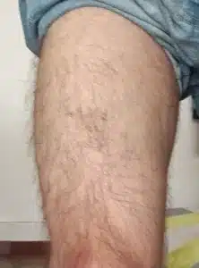 le développement de mes quadriceps