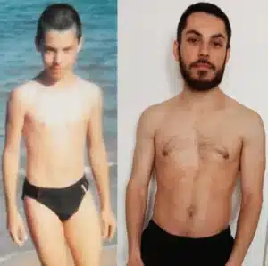 ma transformation physique avant après où j'ai pris 10 kg
