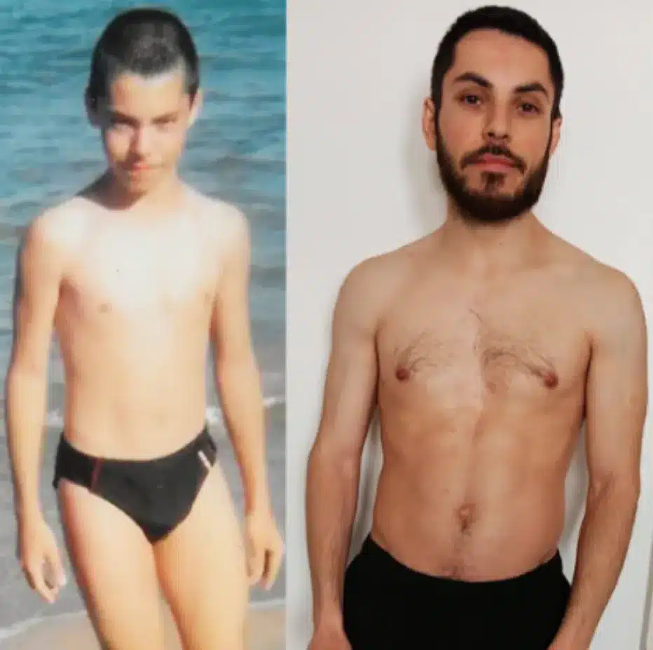 ma transformation physique avant après où j'ai pris 10 kg