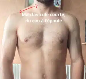 Ma clavicule courte, du cou à l'épaule