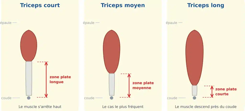 différence entre triceps court, intermédiaire et long