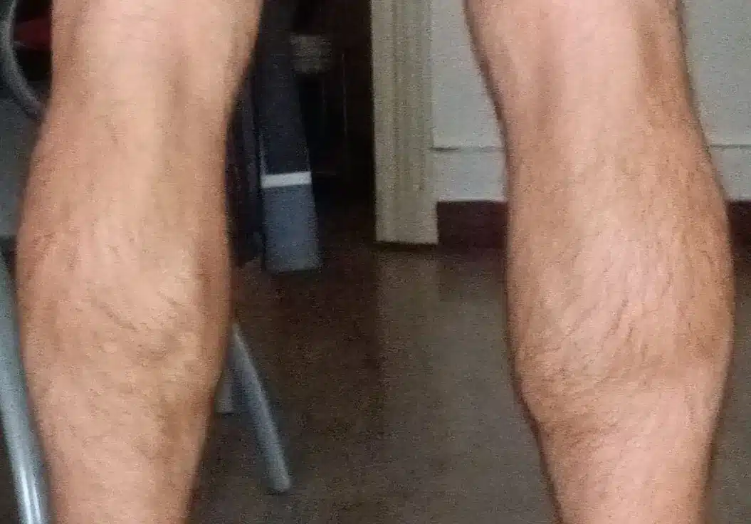 Le guide morpho-anatomique des muscles des jambes