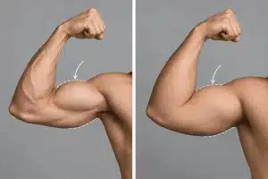 différence de tour de bras entre un profil sec et un profil avec masse graisseuse